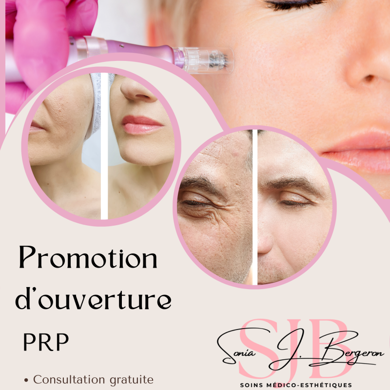 Promotion d’ouverture